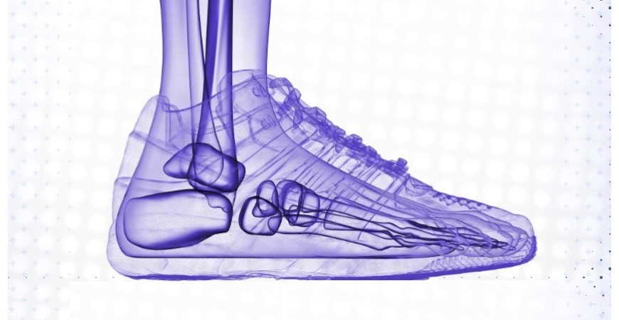 راهنمای انتخاب کفش کتونی و اسنیکر مناسب برای انواع فرم پا؛ از صافی کف پا تا پای پرانتزی